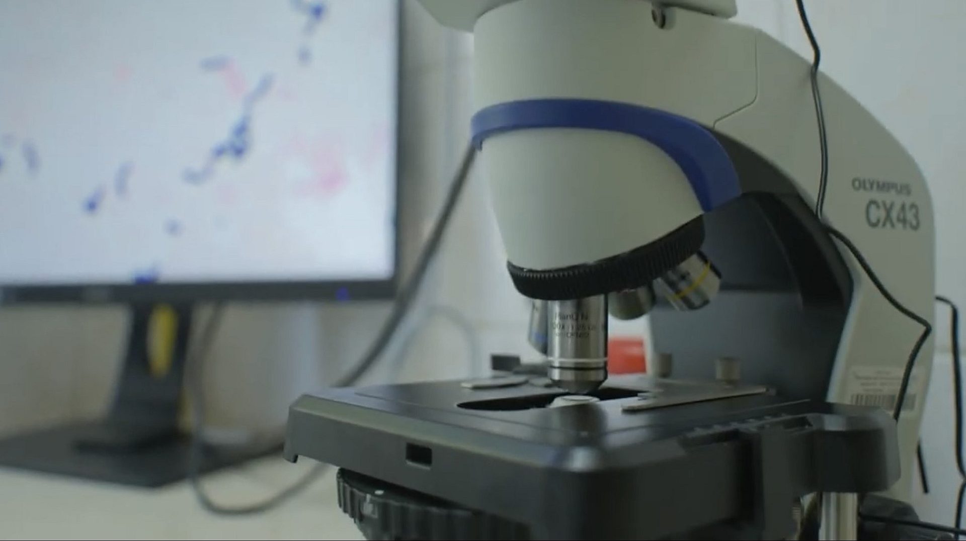 Nowoczesny mikroskop dla zabrzańskiego szpitala Nowoczesny mikroskop dla zabrzańskiego szpitala