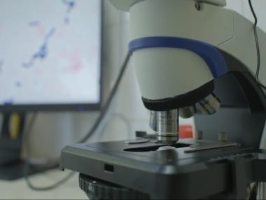 Nowoczesny mikroskop dla zabrzańskiego szpitala Nowoczesny mikroskop dla zabrzańskiego szpitala